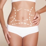 Chirurgia estetica del corpo - Addominoplastica